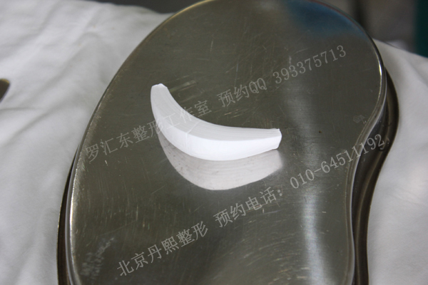 独家揭秘膨体垫下巴雕刻全过程
